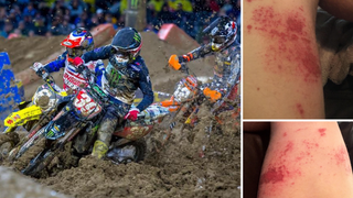 Supercross Riders Show Up With Severe Rashes After Race, Blame Drying Agent<em></em>